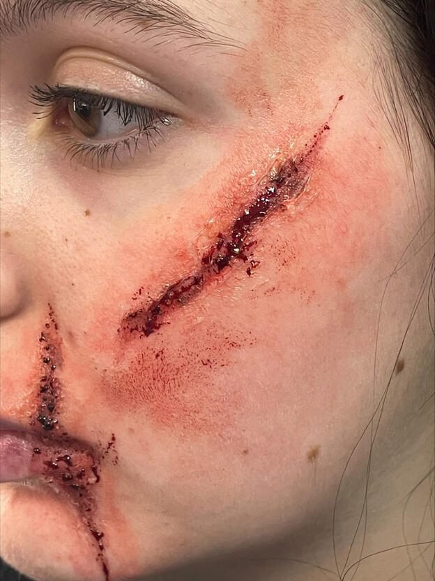 2025 sculpt gel casualty practice